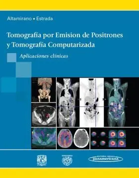 Tomografia por Emision de Positrones y Tomografia Computerizada