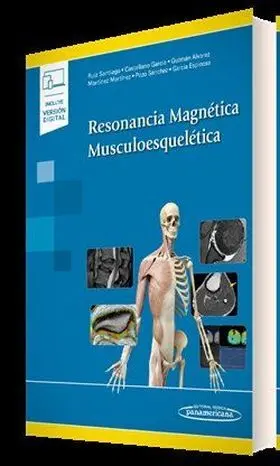 Resonancia Magnètica Musculoesquelètica (Versión Dúo)