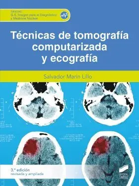 Tecnica de Tomografia Computarizada y Ecografia 3A Edicion Revisada