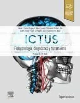 Ictus: Fisiopatología, Diagnóstico y Abordaje