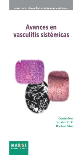 Avances en Vasculitis Sistemicas