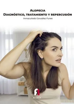 Alopecia. Diagnostico, Tratamiento y Repercusion