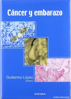 Cancer y Embarazo