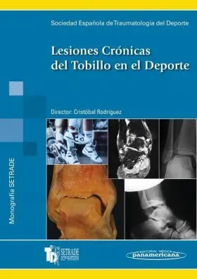 Lesiones Cronicas del Tobillo en el Deporte
