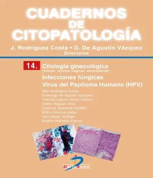 Citologia Ginecologica: Infecciones Fungicas. virus
